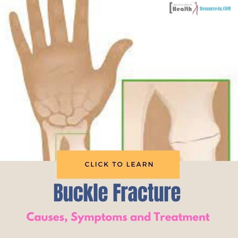 Buckle Fracture : Causes, Symptoms and Treatment